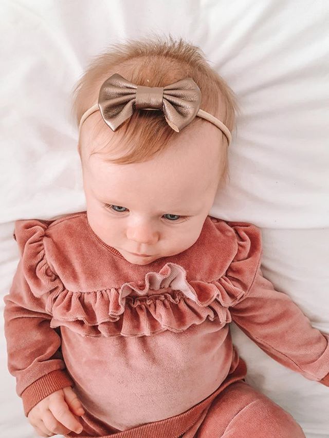 Party Mustard Hairbow Set